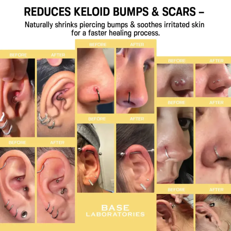 Piercing Bump Care Bundle
